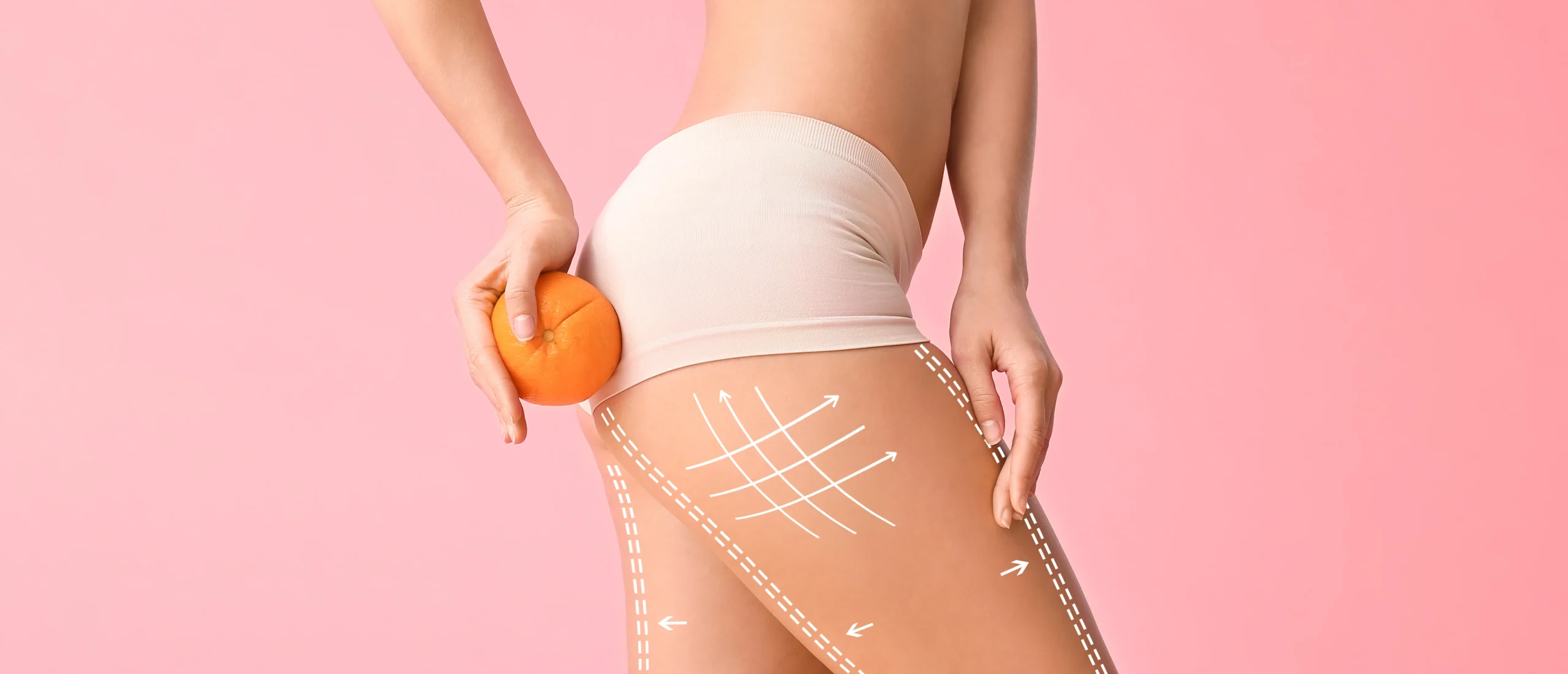 Udo kobiety z efektem cellulitu, pomarańczą i graficznymi liniami modelującymi sylwetkę